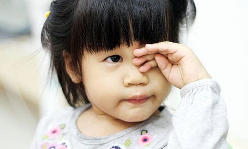 5 lưu ý các mẹ không được quên khi điều trị đau mắt đỏ cho trẻ tại nhà