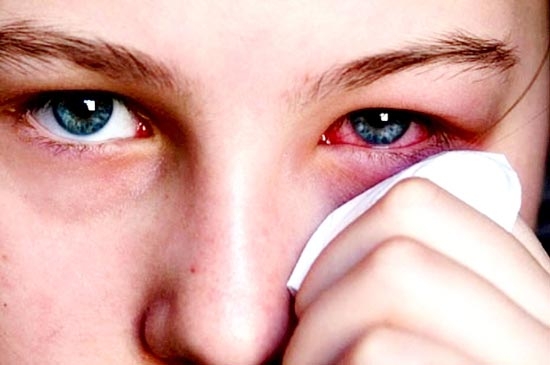 Cân nhắc chế độ ăn uống cho người điều trị đau mắt đỏ